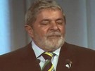 Após série de exames, ex-presidente Lula descobre tumor