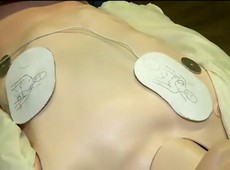 Doenças cardiovasculares matam 350 mil brasileiros por ano