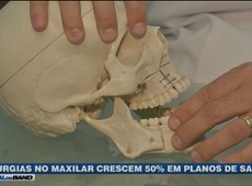 Cirurgias no maxilar crescem 50% em planos de saúde