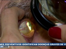 Exames preventivos identificam doenças graves de visão