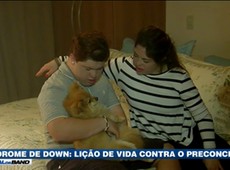 Síndrome de Down: Lição de vida contra o preconceito