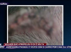 Solta mulher que atropelou ex