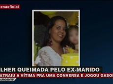 Mulher é queimada pelo ex-marido