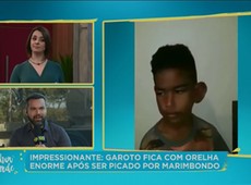 Garoto fica com orelha enorme após picada de marimbondo
