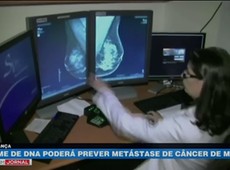 Exame de DNA poderá prever metástase de câncer de mama