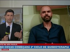 Bruno Covas deve iniciar procedimento nesta terça-feira
