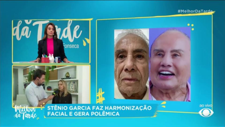Dermatologistas comentam harmonização facial de Stenio Garcia