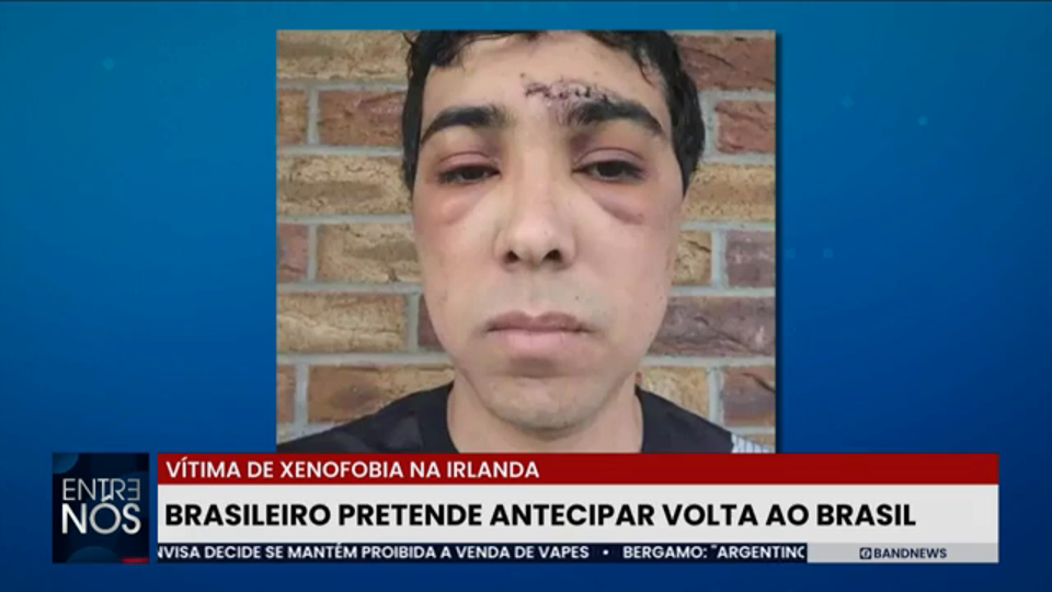 Brasileiro quer deixar a Irlanda após sofrer ataque xenofóbico no país