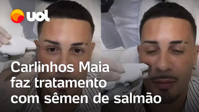 Carlinhos Maia faz tratamento de pele com sêmen de salmão! Especialista explica método!