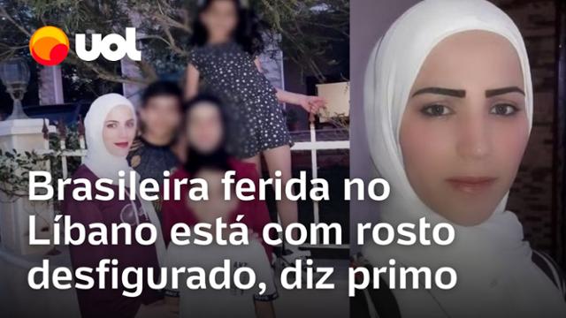 Brasileira ferida em ataque no Líbano está com rosto desfigurado; criança está em estado grave 
