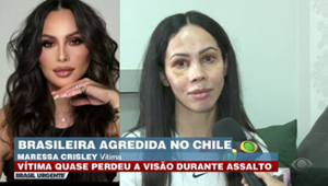 Brasileira agredida no Chile diz que quase perdeu a visão