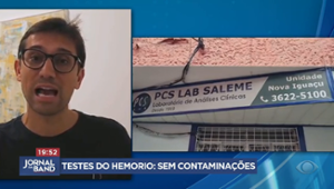 Schneider: testes já feitos no Hemorio não indicam contaminações