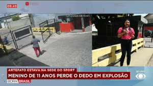 Menino perde o dedo em explosão na saída do Sport Club no Recife