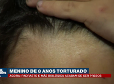 Menino de 8 anos torturado: mãe e padrasto presos