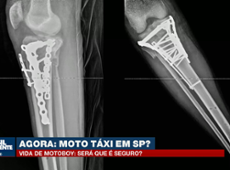 Vida de motoboy:  jovem entregador vê a vida mudar após trágico acidente