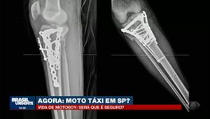 Vida de motoboy:  jovem entregador vê a vida mudar após trágico acidente