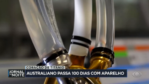 Australiano passa 100 dias com coração feito de titânio