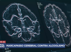 Marcapasso cerebral pode ser alternativa contra o alcoolismo
