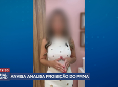 Anvisa analisa proibição do uso do PMMA